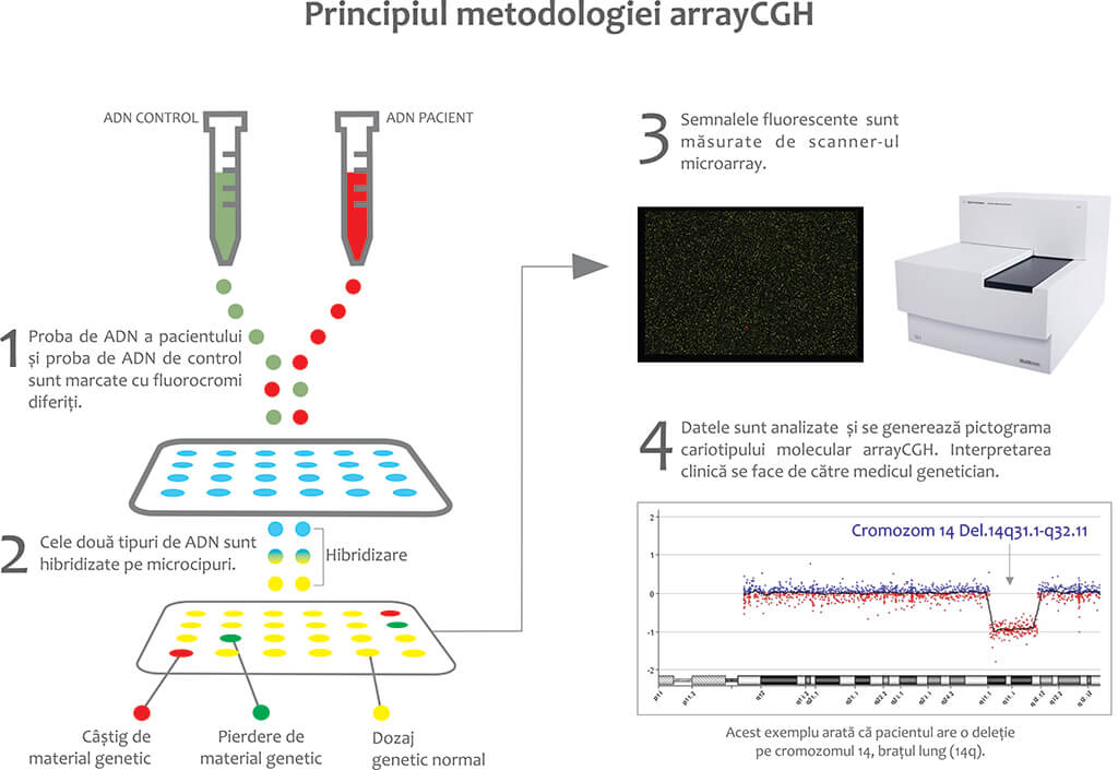 Fig.2 Infografic aCGH