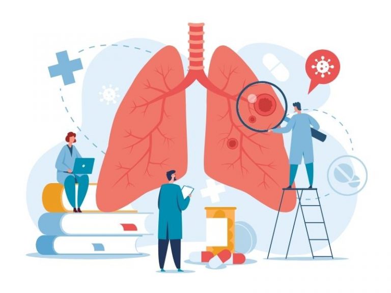 cancer pulmonar, simptome cancer pulmonar, analize cancer pulmonar, cancer la plamani, simptome cancer la plamani, leucocite marite, apa la plamani